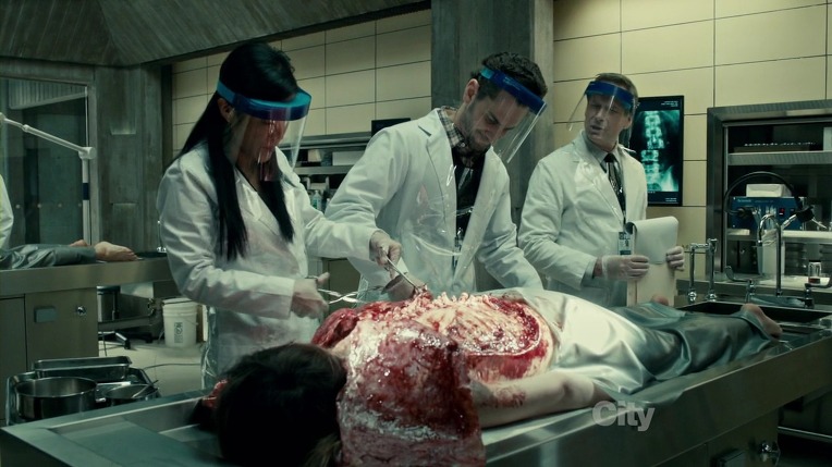 본격침샘어택미드 한니발(Hannibal) 시즌1 에피5 (2/4) *시체주의* | 인스티즈