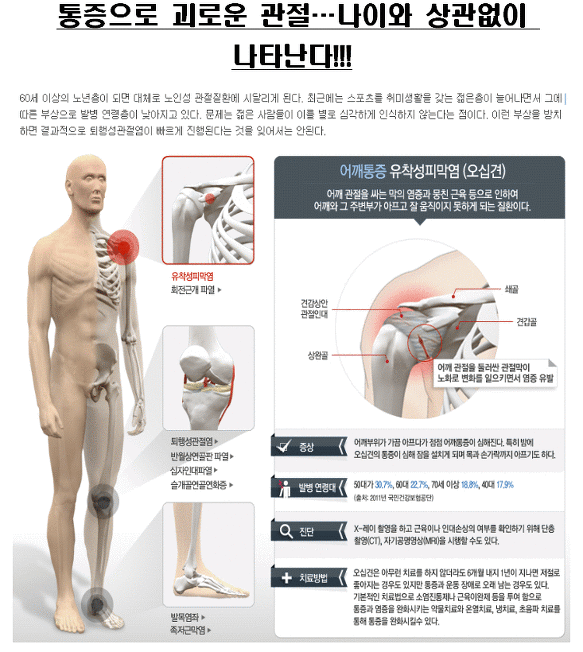 통증으로 괴로운 관절... 나이와 상관없이 나타난다!!!